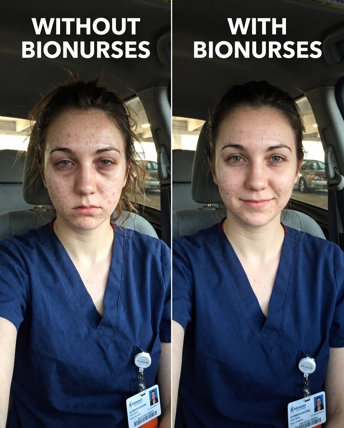 The same nurse — exhausted before, refreshed with BioNurses