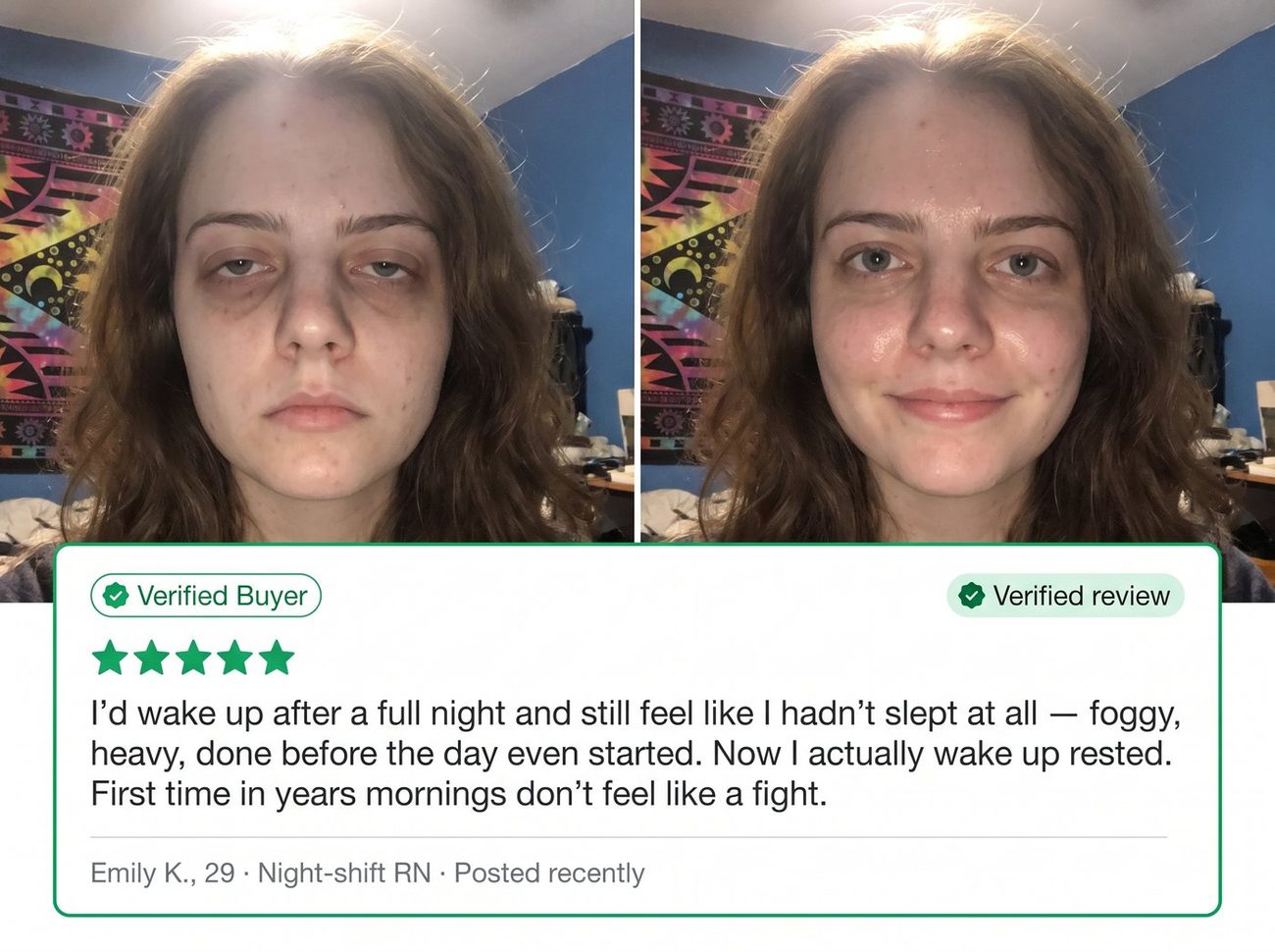 Verified nurse review — before and after BioNurses